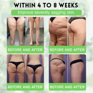 Genayu®️ MORINGA+BERBERINE Advenaced Nano Microneedle Patch| Supports Metabolism, Weight Management, Heart Health & More