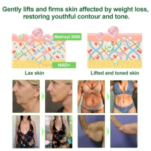 Genayu®️ MORINGA+BERBERINE Advenaced Nano Microneedle Patch| Supports Metabolism, Weight Management, Heart Health & More